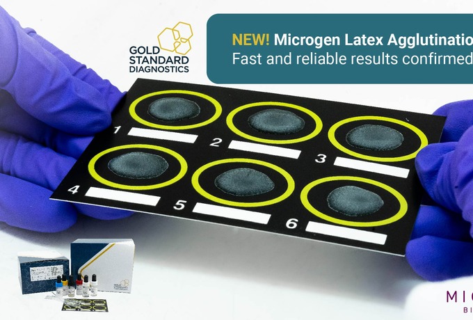 Your solution for confirming Salmonella, Staphylococcus aureus, and Legionella in food and environmental samples.